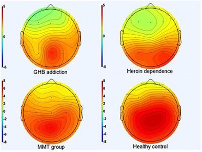 A Comparison Study of Impulsiveness, Cognitive Function, and P300 Components Between Gamma-Hydroxybutyrate and Heroin-Addicted Patients: Preliminary Findings